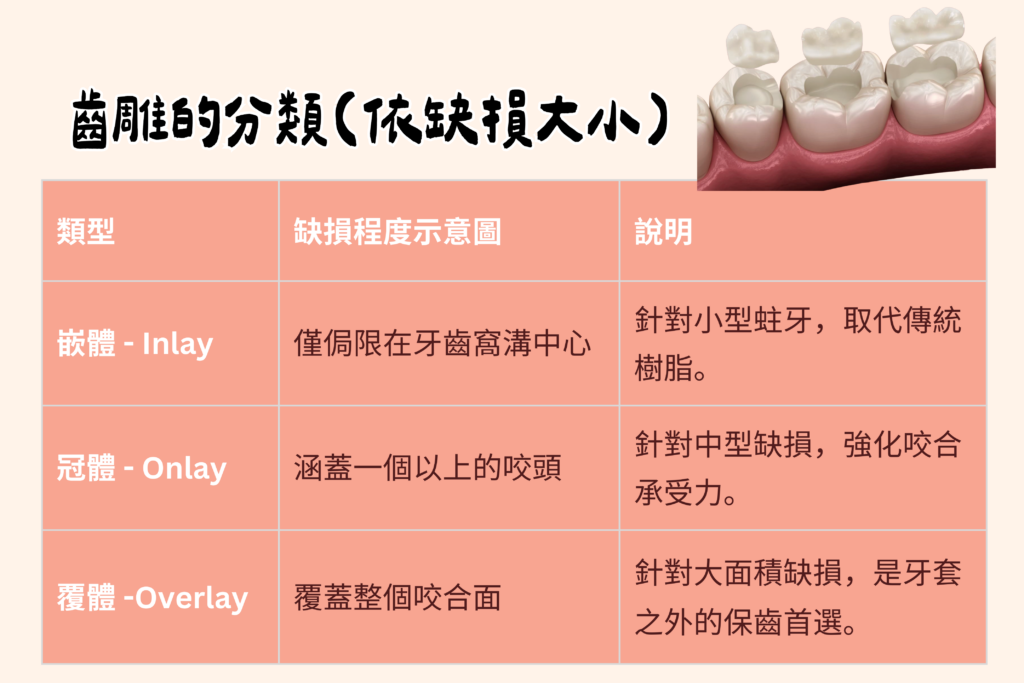 inlay onlay overlay 東嶼齒雕分析
