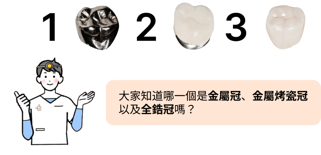 假牙材質猜猜看