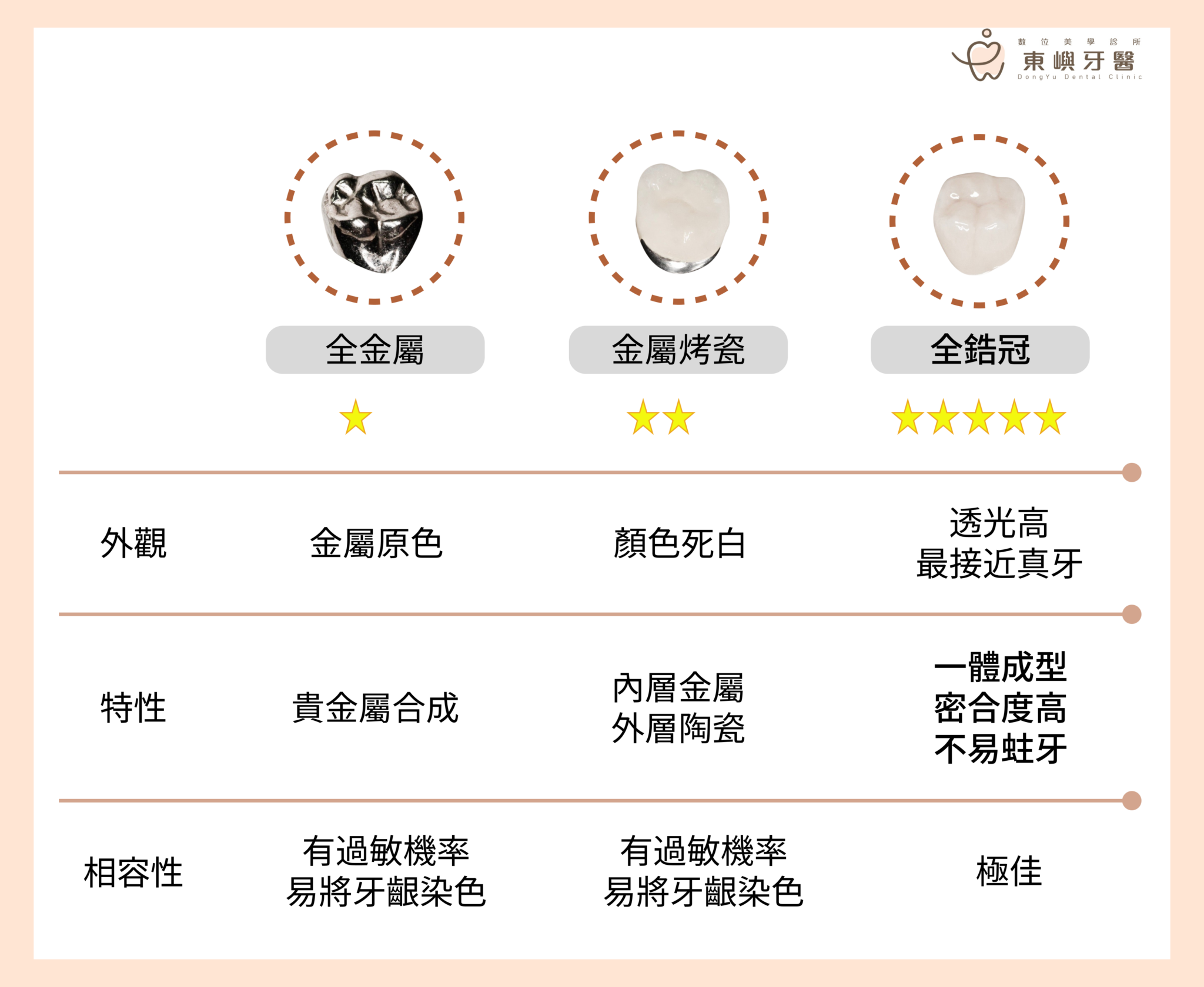 東嶼牙醫牙冠差異解說
