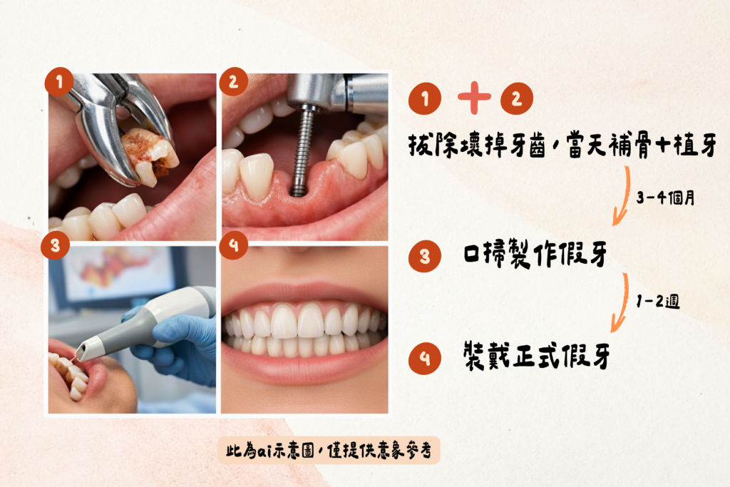 東嶼牙醫及拔及植示意圖