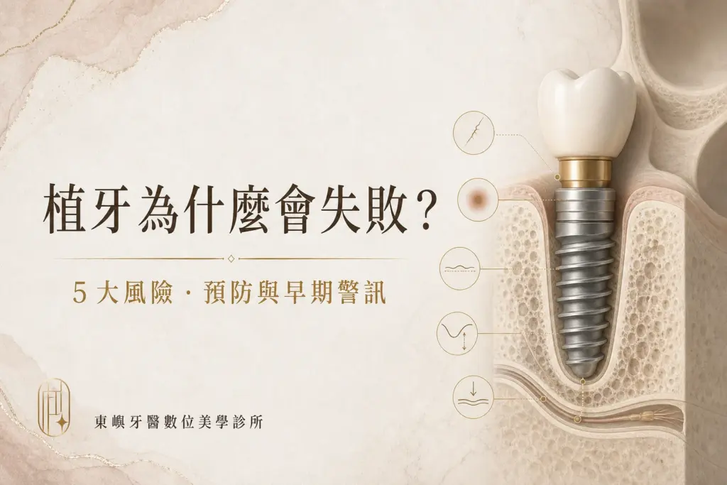 植牙為什麼會失敗？5 大風險、預防與早期警訊｜東嶼牙醫數位美學診所