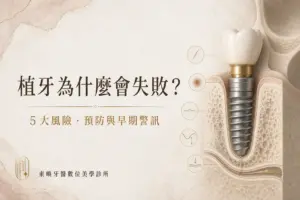 植牙為什麼會失敗？5 大風險、預防與早期警訊｜東嶼牙醫數位美學診所