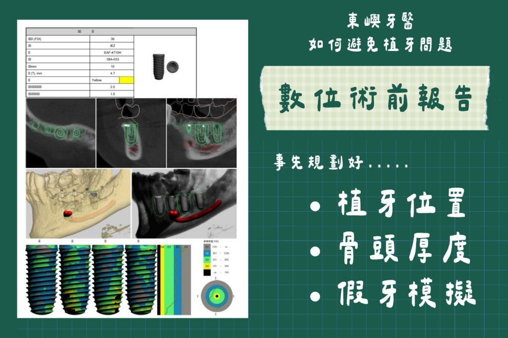 便宜植牙_術前規劃