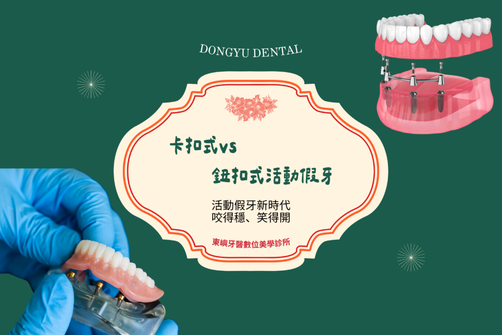 卡扣式活動假牙 VS 鈕扣式文章封面