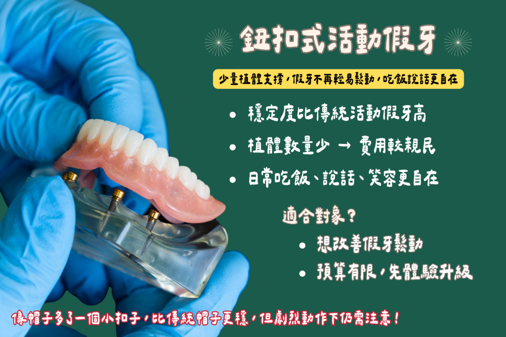 東嶼卡扣式活動假牙 VS 鈕扣式文章1