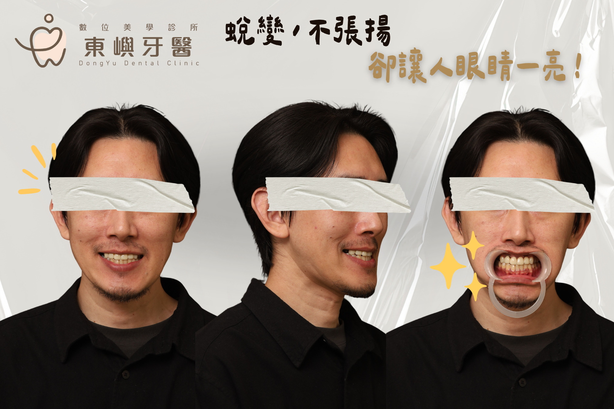 假牙三方面拍攝(人物誌)