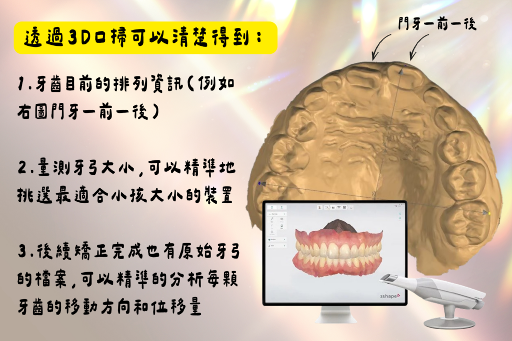 東嶼牙醫 x 台南肌功能矯正 3D口掃機介紹