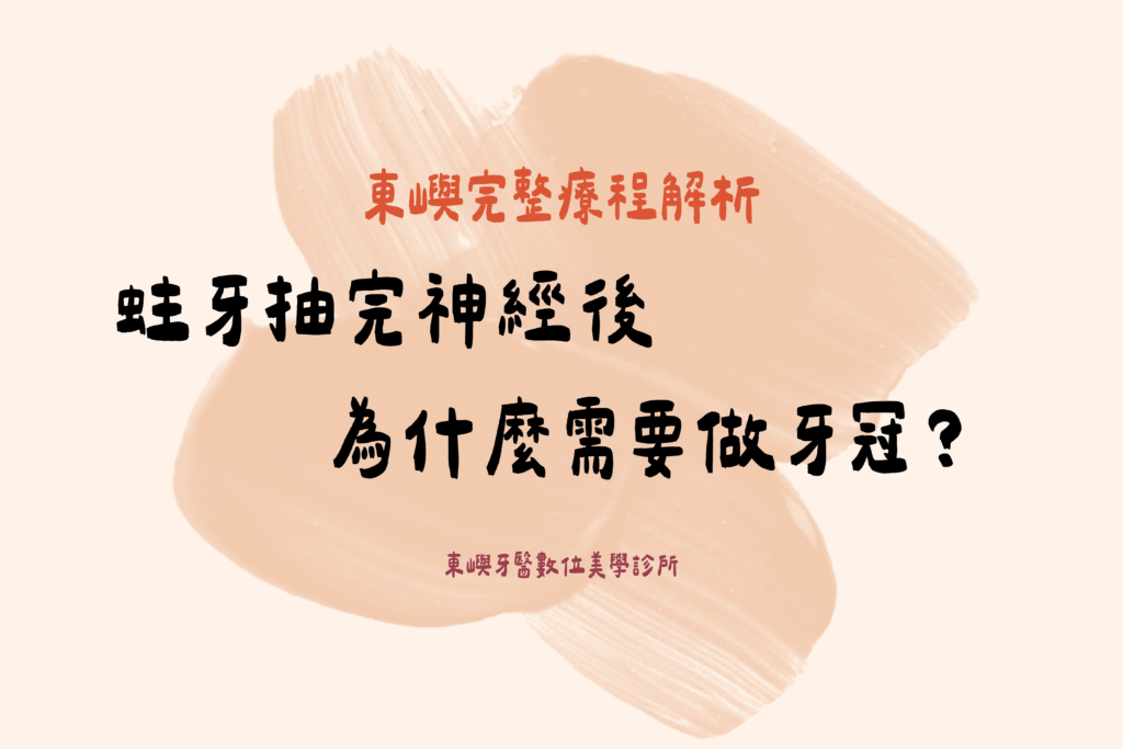 蛀牙抽完神經後 為什麼需要做牙冠？封面