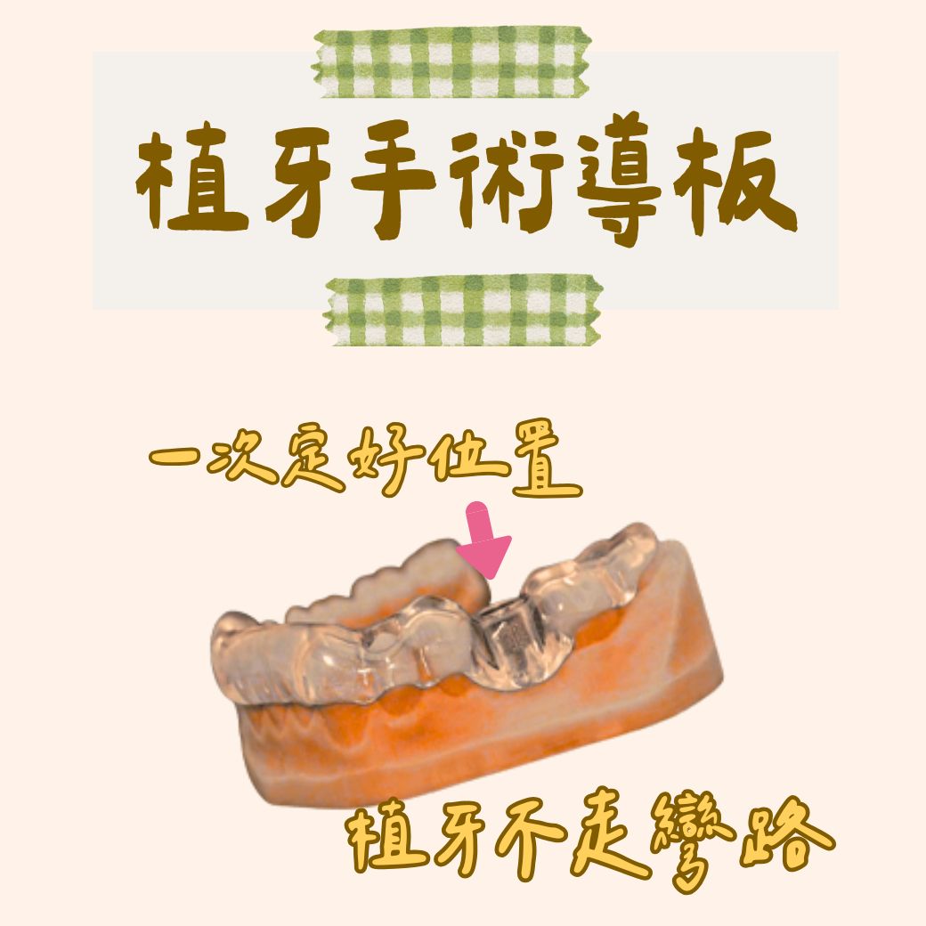 東嶼植牙手術導板
