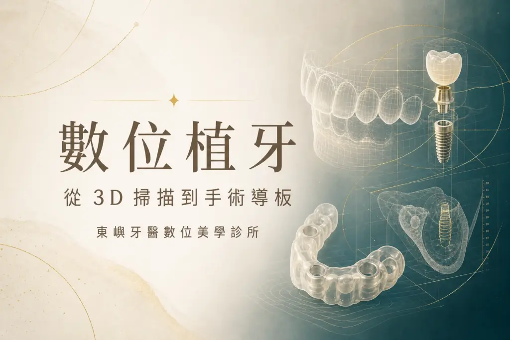 數位植牙｜從 3D 掃描到手術導板｜東嶼牙醫數位美學診所