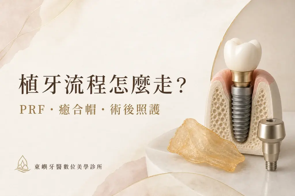 植牙流程怎麼走？PRF、癒合帽與術後照護｜東嶼牙醫數位美學診所