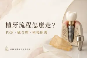 植牙流程怎麼走？PRF、癒合帽與術後照護｜東嶼牙醫數位美學診所
