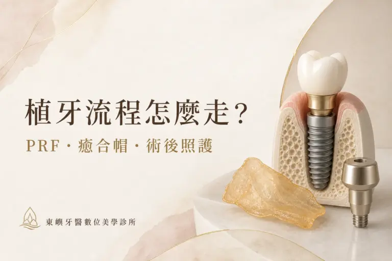 植牙流程怎麼走？PRF、癒合帽與術後照護｜東嶼牙醫數位美學診所