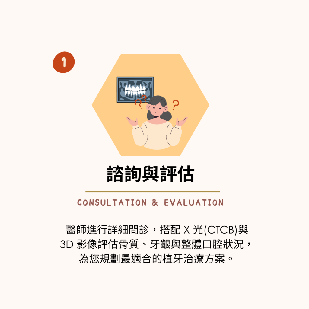 東嶼植牙簡易流程1