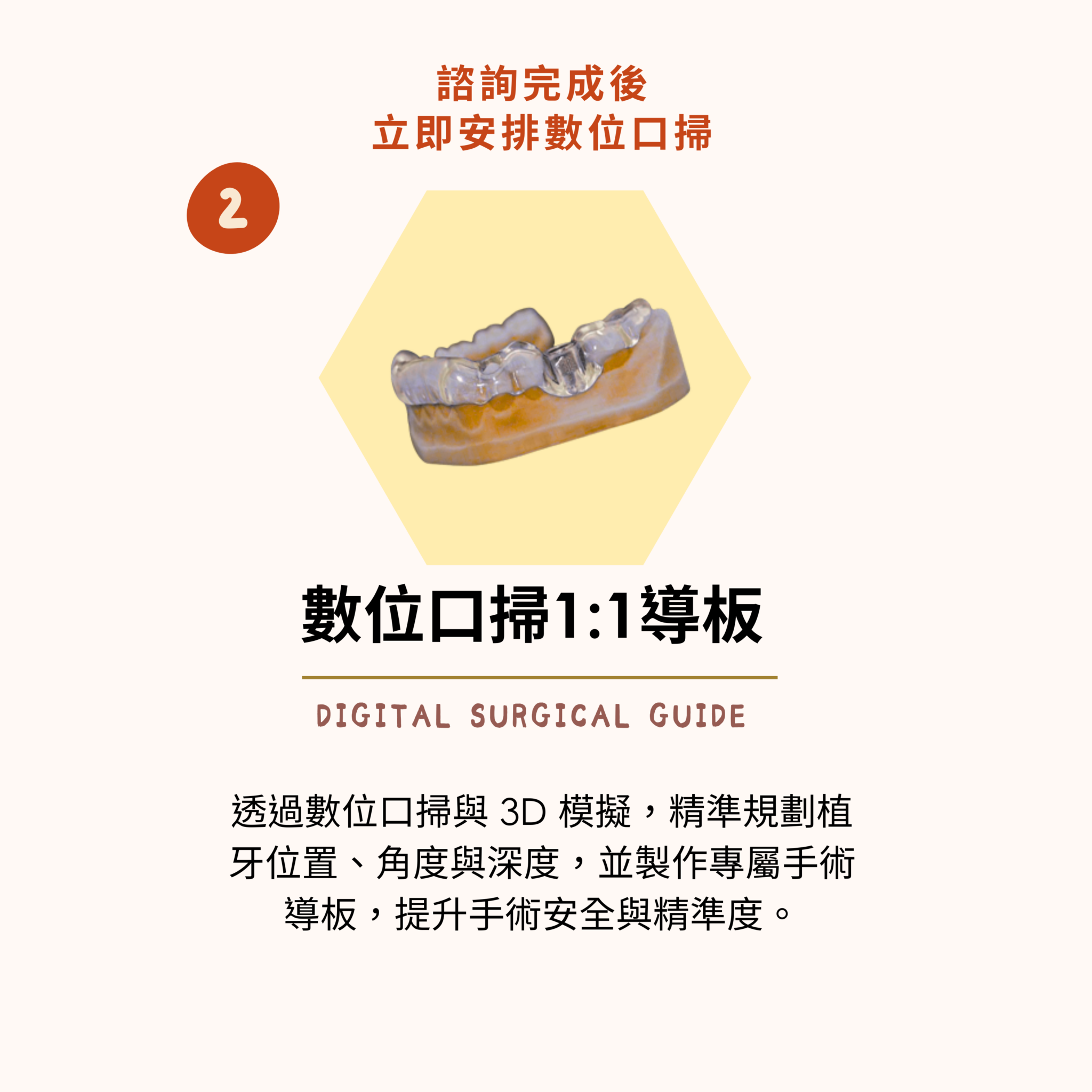 東嶼植牙簡易流程2