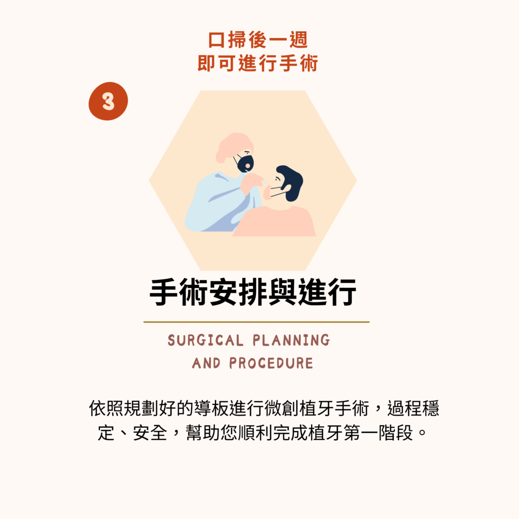 東嶼植牙簡易流程3