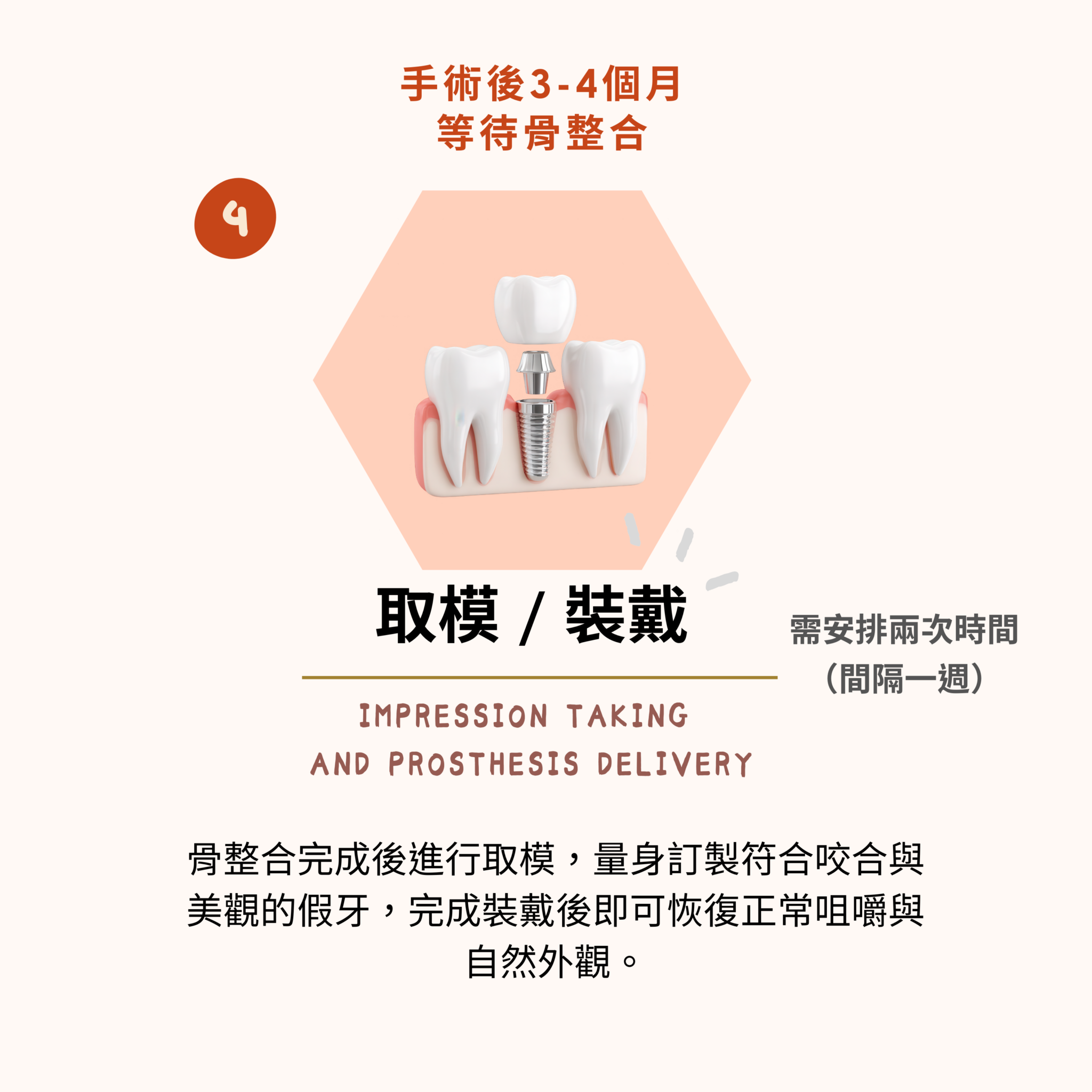 東嶼植牙簡易流程4