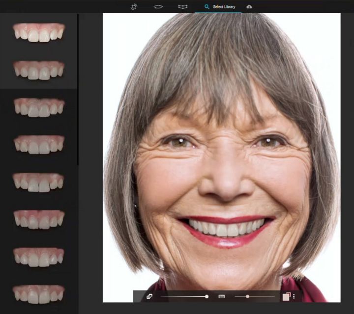 Full-arch-SmileCloud