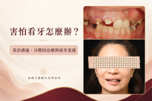 害怕看牙患者分階段治療與前牙重建案例封面｜東嶼牙醫數位美學診所