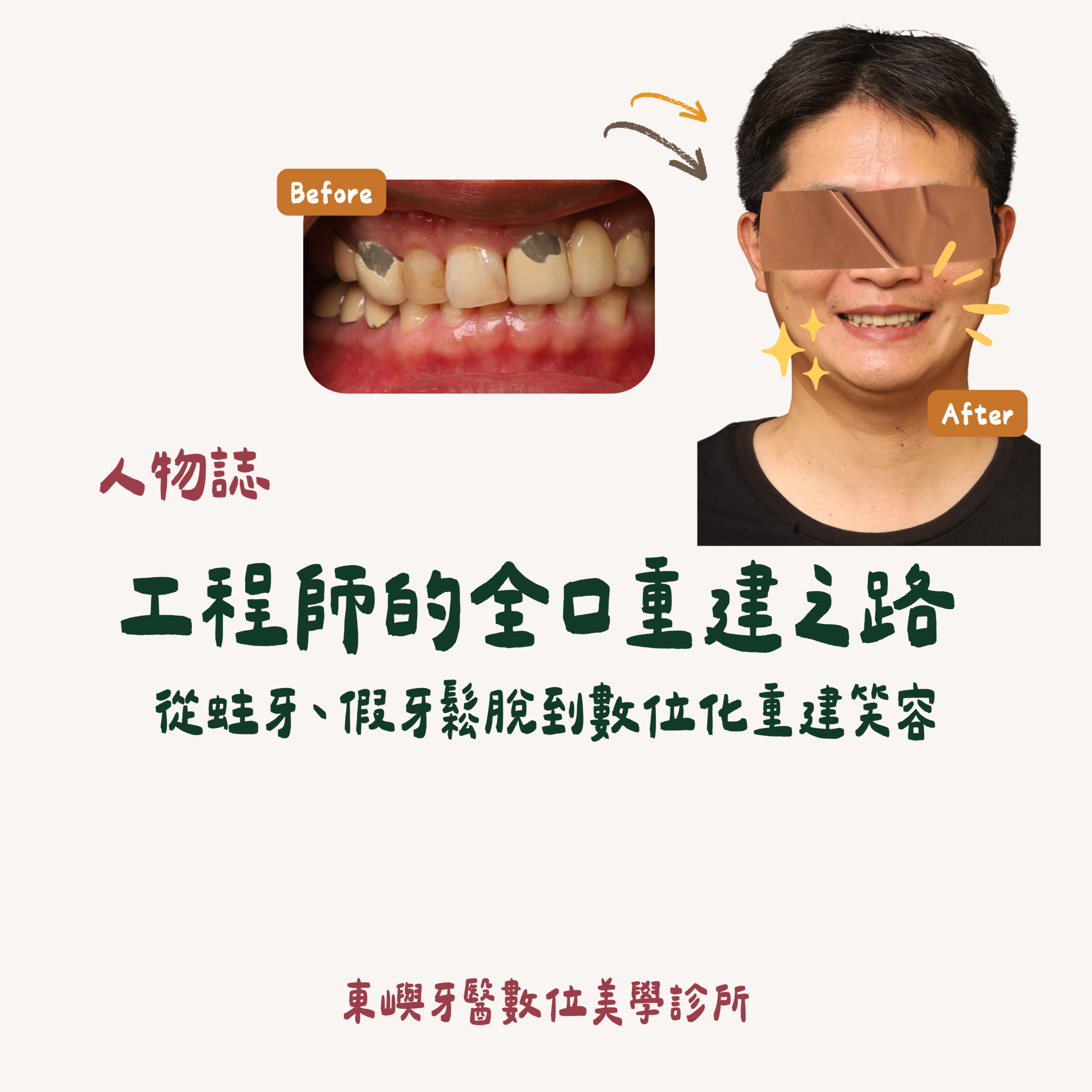 工程師的全口重建之路 縮圖