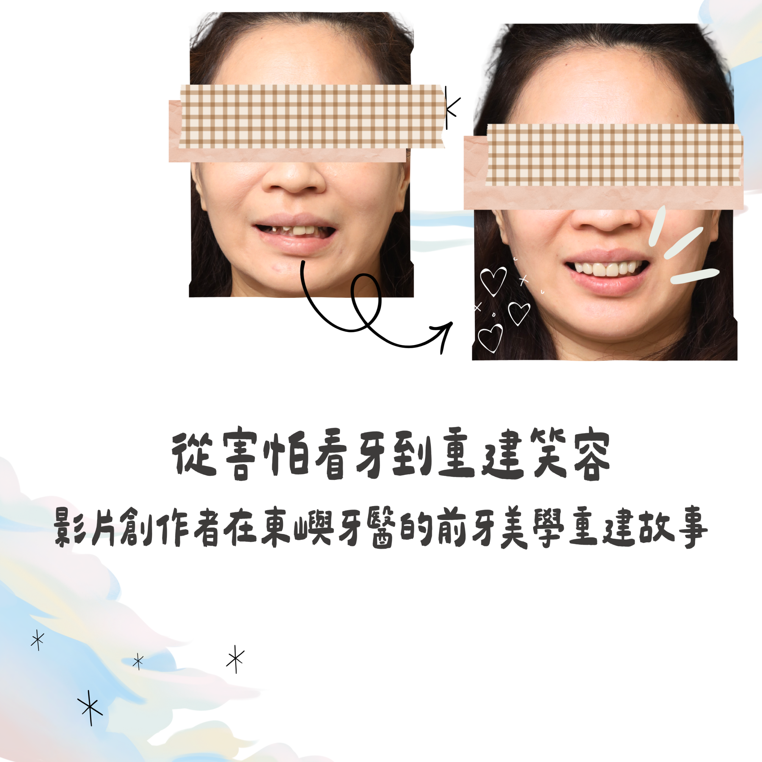 從害怕看牙到重建笑容 縮圖2