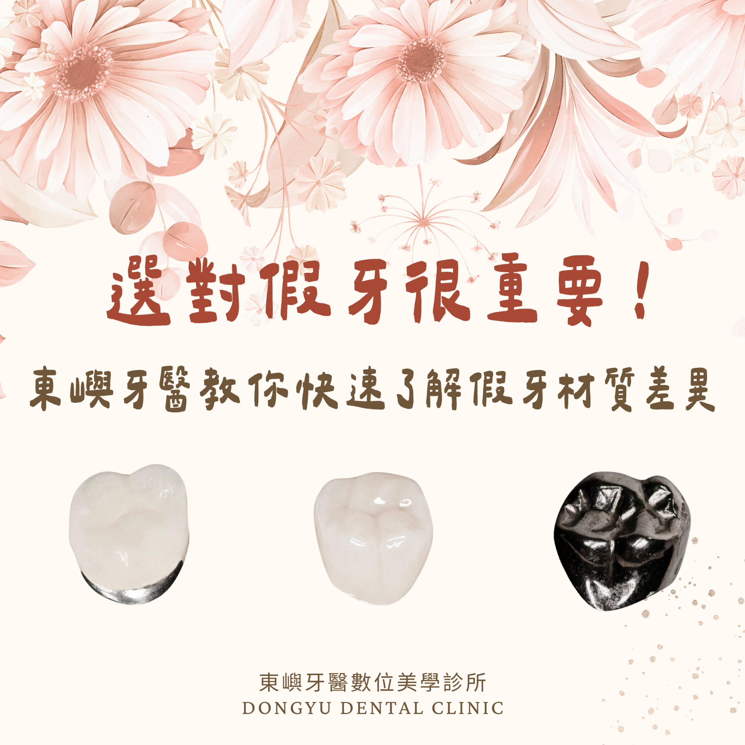 (有圖)選對假牙很重要！東嶼牙醫教你快速了解假牙材質差異