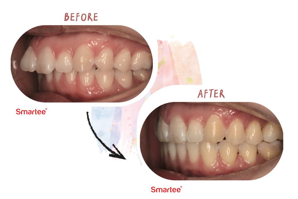 東嶼smartee案例3-2