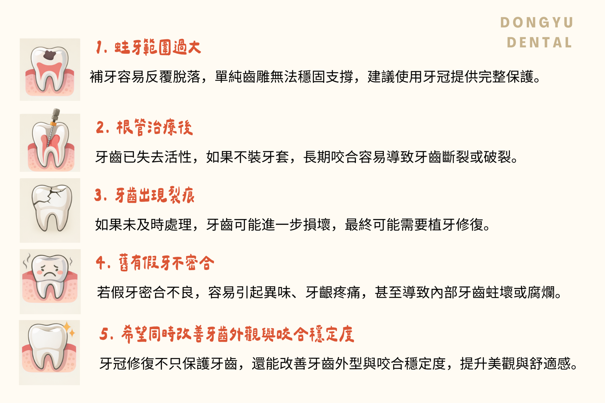 美學假牙-哪些情況適合評估全鋯冠假牙？ (2)