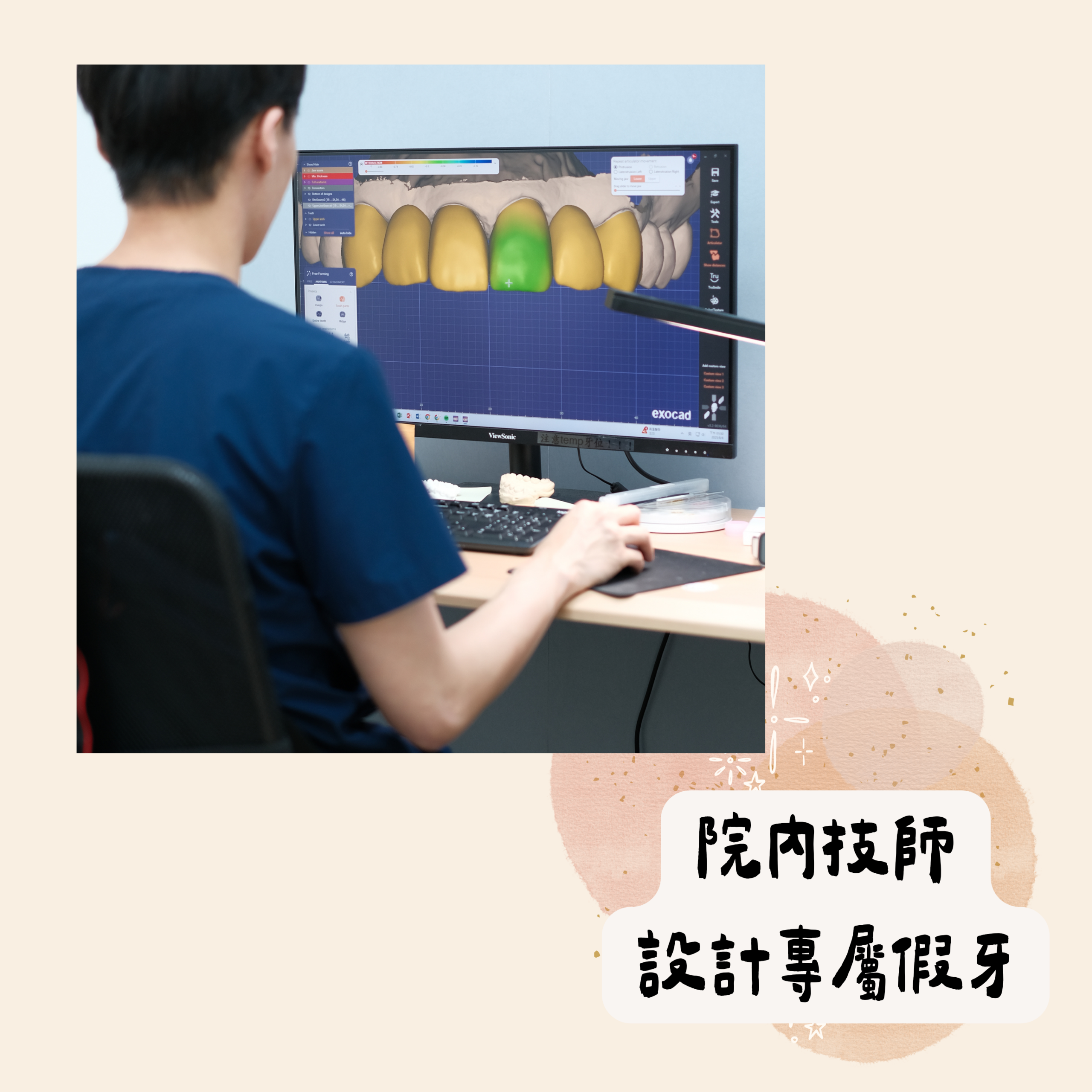 院內技師 設計專屬假牙