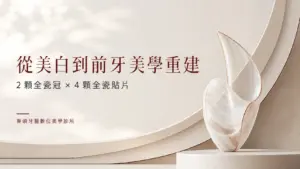 從美白到前牙美學重建｜2 顆全瓷冠搭配 4 顆全瓷貼片案例