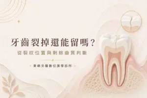 牙齒裂紋位置與剩餘齒質評估示意｜東嶼牙醫