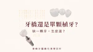 牙橋還是單顆植牙？缺一顆牙怎麼選｜東嶼牙醫數位美學診所