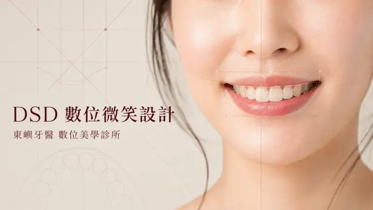 DSD數位微笑設計文章封面｜東嶼牙醫數位美學診所