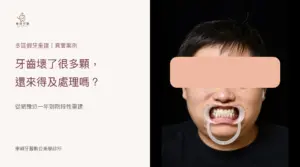 牙齒壞了很多顆多區假牙重建案例封面