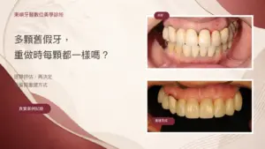 多顆舊假牙逐顆評估與固定式重建案例封面